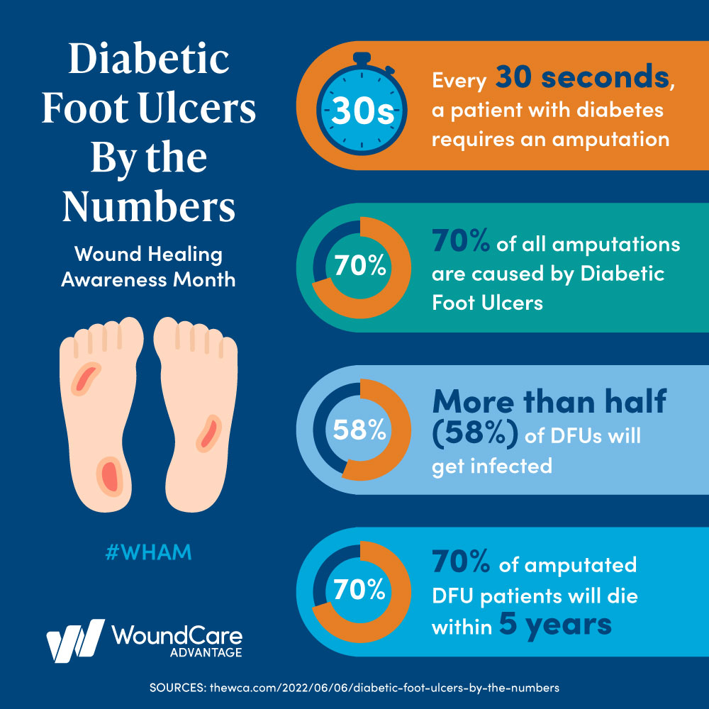new research in diabetic foot ulcer