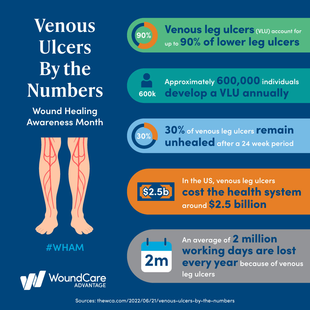 Venous Ulcers By The Numbers Wound Care Advantage